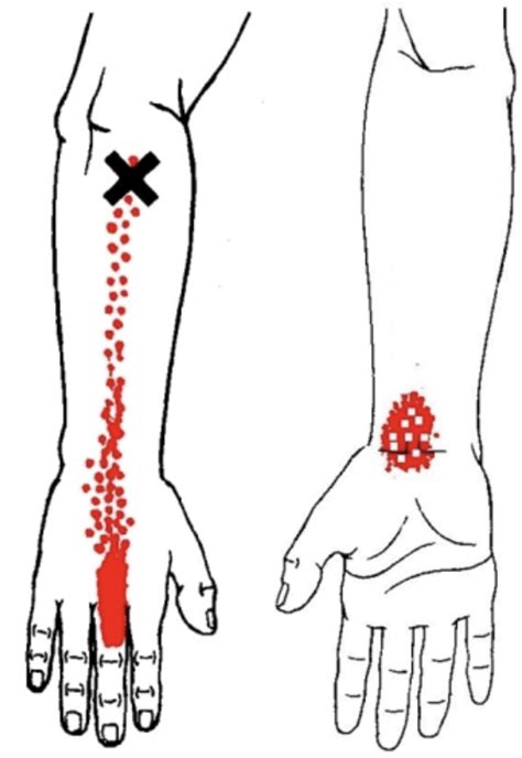 nag finger|Finger Pain Self Assessment — Grassroots Physical Therapy.
